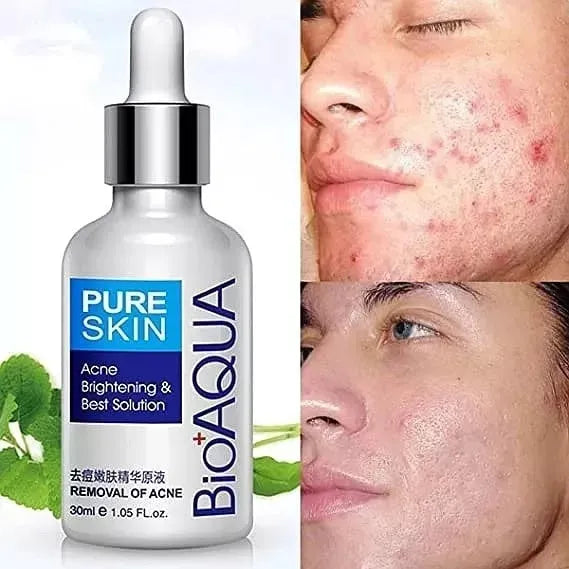 SERUM REMOVEDOR ANTIACNE BIOAQUA