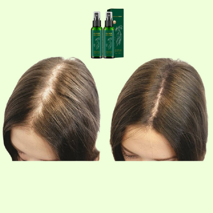 Tónico Capilar Ouhoe – Engrosa, regenera y fortalece el cabello desde la raíz