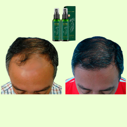 Tónico Capilar Ouhoe – Engrosa, regenera y fortalece el cabello desde la raíz